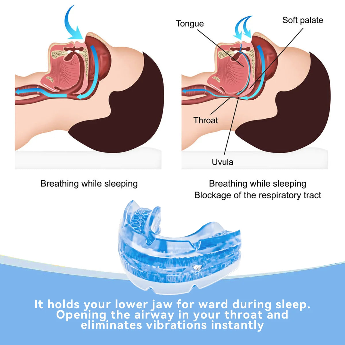 Anti Snore Bruxism Mouth Guard Stop Snoring Mouthpiece Teeth Bruxism Sleeping Aid Apnea Devices Night Anti-Snoring Mouth Guard GoodSnoze