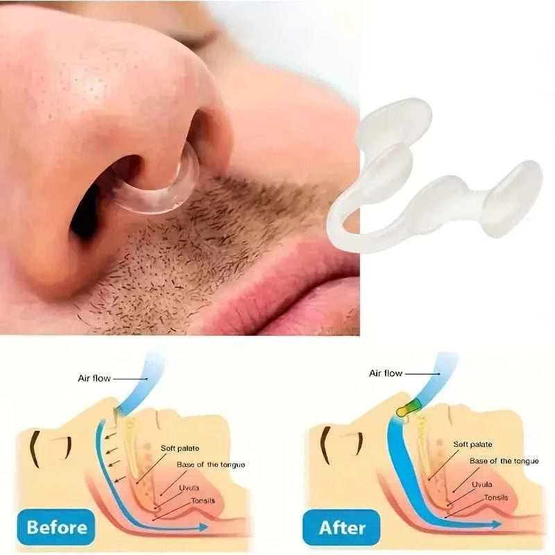 NoseClip™